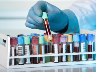 سابقة من نوعها: مختبر طبي يعفي الأطفال من مصاريف التحاليل الطبية缩略图