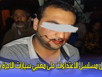 تواصل مسلسل الاعتداءات على مهنيي سيارات الاجرة بوجدة缩略图