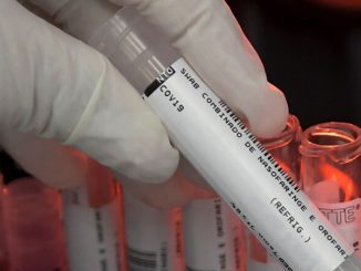 منظمة الصحة: كورونا موجة كبيرة واحدة وليست موسمية缩略图