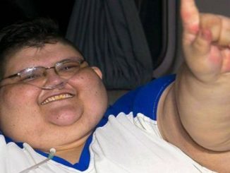 أضخم رجل في العالم ينتصر على كورونا缩略图