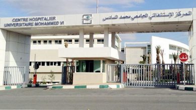 قسم الإنعاش والتخذير بالمستشفى الجامعي محمد السادس بوجدة