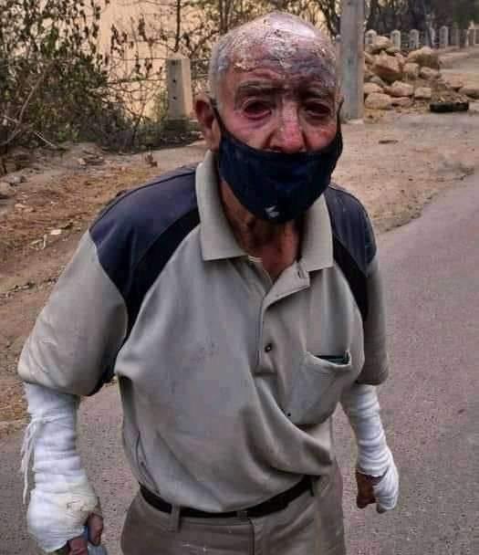 الجزائر تحترق – يرجى عدم تصفح الصور للأقل من 18 سنة-插图4