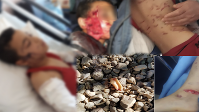 كلاب شرسة تنهش جسد طفل داخل مؤسسة تعليمية بوجدة缩略图