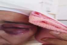 بسبب قفة رمضان… قائد مقاطعة القصبة بمدينة العيون الشرقية يبرح سيدة ضربا缩略图