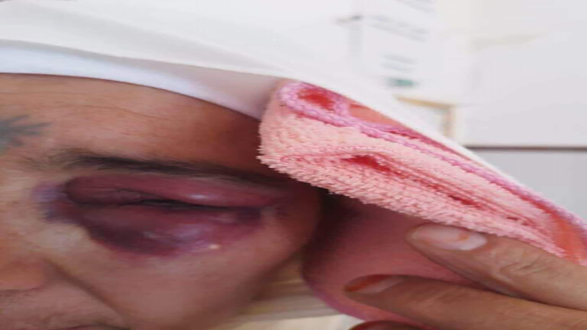 بسبب قفة رمضان… قائد مقاطعة القصبة بمدينة العيون الشرقية يبرح سيدة ضربا缩略图