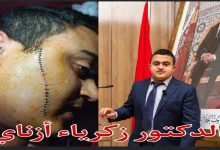 في قلب الحرم الجامعي: دكتور في الرياضيات بجامعة وجدة يتعرض “لتشرميل” من طرف شخص مخمور وتحت تأثير المخدرات缩略图