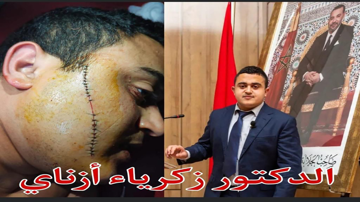 في قلب الحرم الجامعي: دكتور في الرياضيات بجامعة وجدة يتعرض “لتشرميل” من طرف شخص مخمور وتحت تأثير المخدرات缩略图