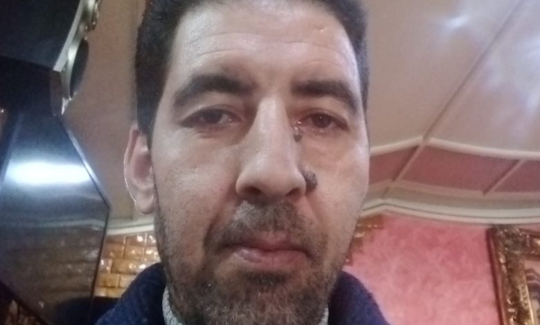 هشام زهدالي : هل كان بعيوي والناصيري يراهنان على تأسيس نموذج كولومبيا لكارتيل سياسي بالمخدرات ؟ -الحلقة الثانية-缩略图 هشام زهدالي : هل كان بعيوي والناصيري يراهنان على تأسيس نموذج كولومبيا لكارتيل سياسي بالمخدرات ؟ -الحلقة الثانية-缩略图