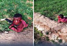 الرشيدية: الكلاب الضالة ترسل طفل صغير الى المستعجلات缩略图 الرشيدية: الكلاب الضالة ترسل طفل صغير الى المستعجلات缩略图