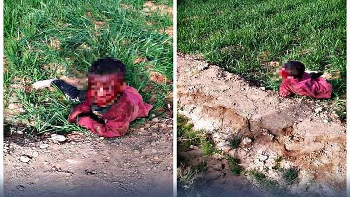 الرشيدية: الكلاب الضالة ترسل طفل صغير الى المستعجلات缩略图