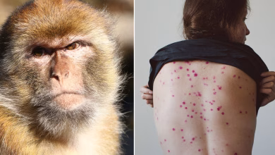 جدري القردة: منظمة الصحة العالمية تعلن حالة طوارئ صحية عالمية وتوقعات بعدم توفر اللقاح قبل أشهر缩略图