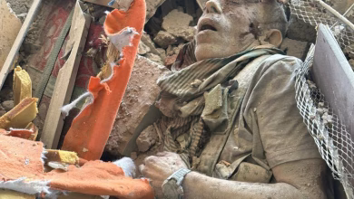 ما قصة إصبع السنوار المقطوعة والسلك على يده ولماذا جرد من زيه العسكري؟缩略图