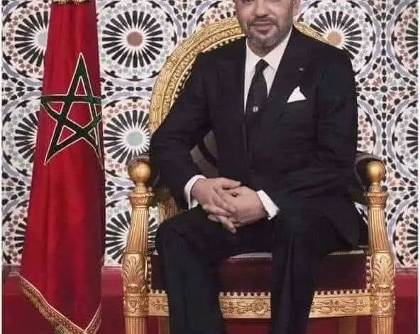 بالشفاء العاجل لجلالة الملك بعد تعرضه لكسر.缩略图 بالشفاء العاجل لجلالة الملك بعد تعرضه لكسر.缩略图