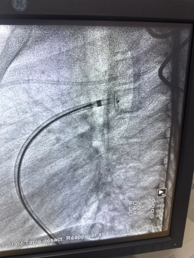 نجاح القافلة الطبية الثانية لقسطرة القلب التداخلية للأطفال بوجدة插图2