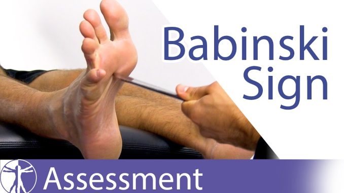 The Babinski Sign or Reflex | Upper Motor Neuron Lesion