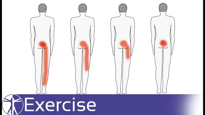 Direction Specific Exercises for Low Back Pain | Directional Preference
